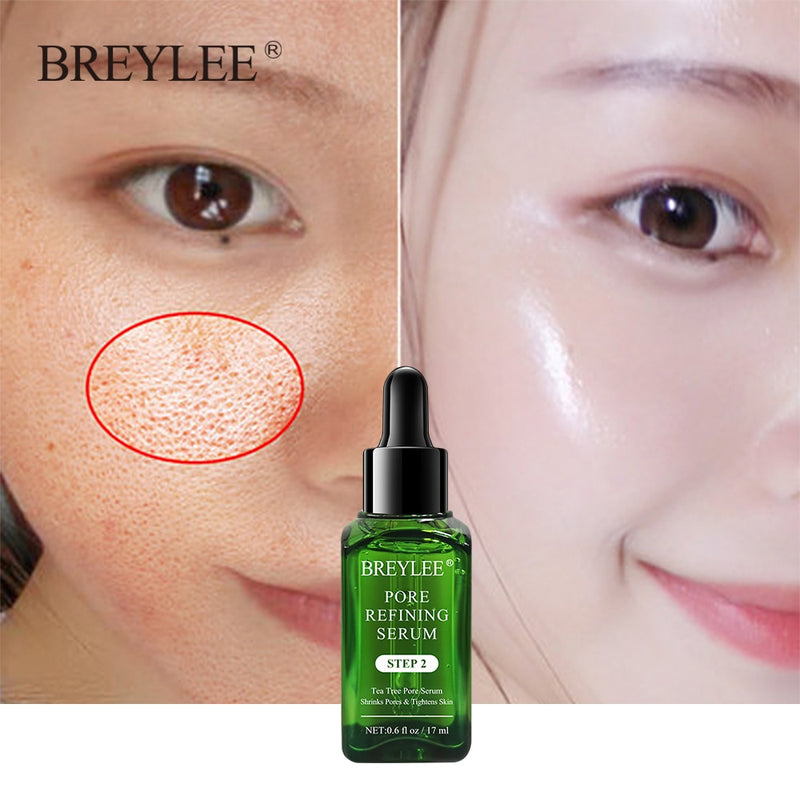 BREYLEE  SÉRUM  encolhedor de poros, para tratamento da acne com essência facial para  remoção de cicatrizes  clareamento anti- ácne e cuidados da pele